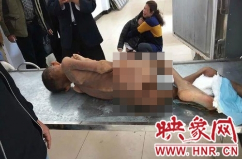 王新红丢失半年的孩子，尸体只剩皮包骨头(家属提供)