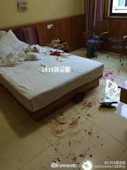 杭州一名男子宾馆内被情人剪掉生殖器(图)