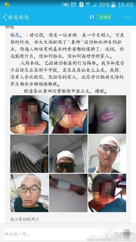 贵州一中学主任持钢棍打副校长 致其左手骨折