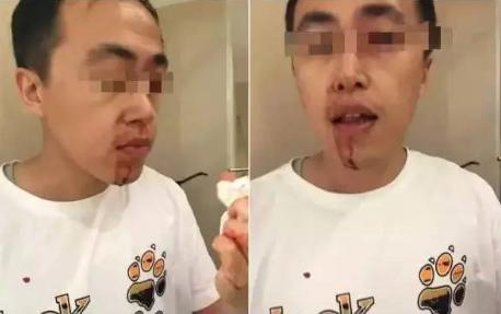 被打者
